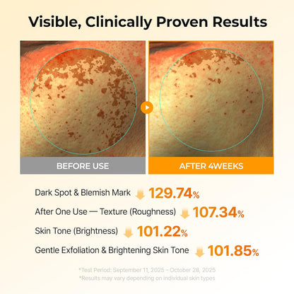 Turmeric & Tranexamic Brightening Serum